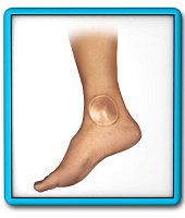 Гелевая защита Bunga pads GD-S